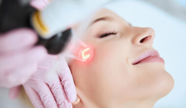 Why Modern Dual Laser Treatments Are Winning the Skin Glow Race