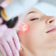 Why Modern Dual Laser Treatments Are Winning the Skin Glow Race