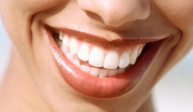 brighten your smile without picking a fight with your teeth