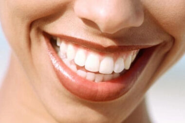brighten your smile without picking a fight with your teeth