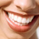 brighten your smile without picking a fight with your teeth