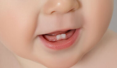 little teeth big clues every parent should notice early
