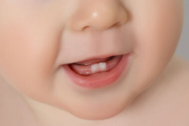 little teeth big clues every parent should notice early