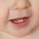 little teeth big clues every parent should notice early