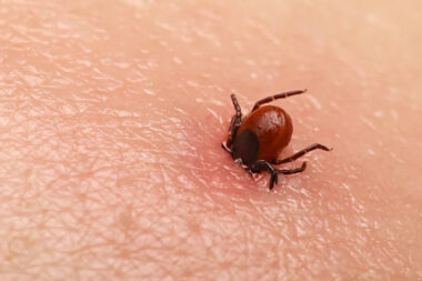 outsmarting ticks before they outsmart you