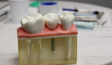 smart ways to pick a dental implant clinic in san antonio