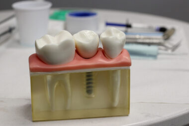 smart ways to pick a dental implant clinic in san antonio