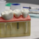 smart ways to pick a dental implant clinic in san antonio