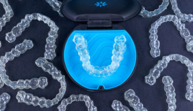 Top 1 Diamond Invisalign