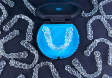 Top 1 Diamond Invisalign