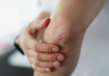 How to Recognize the Early Warning Signs of an Autoimmune Disease
