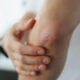 How to Recognize the Early Warning Signs of an Autoimmune Disease