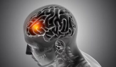 What Makes Traumatic Brain Injuries Difficult to Diagnose