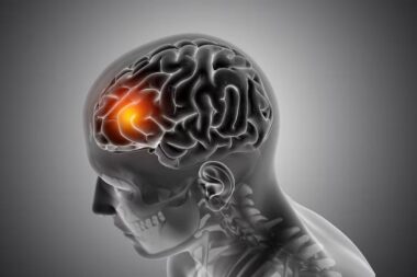 What Makes Traumatic Brain Injuries Difficult to Diagnose