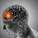 What Makes Traumatic Brain Injuries Difficult to Diagnose