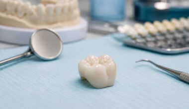 Dental Crowns When Do You Need One and What Should You Expect