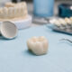 Dental Crowns When Do You Need One and What Should You Expect
