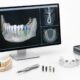Ferber Dental Can Help Patients Request X Guide Dental Implant Surgery for More Precise Treatment Planning
