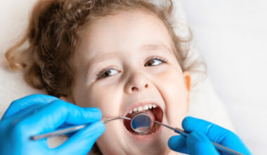 How Pediatric Dentists Treat New Decay Around An Existing Baby Tooth Crown