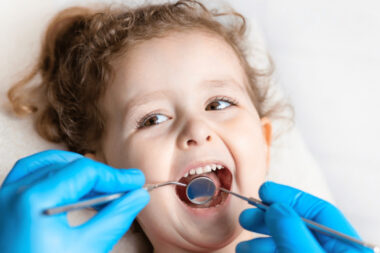 How Pediatric Dentists Treat New Decay Around An Existing Baby Tooth Crown