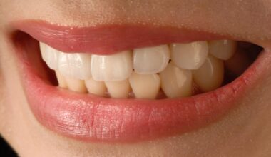 The Functional Side Of Porcelain Veneers